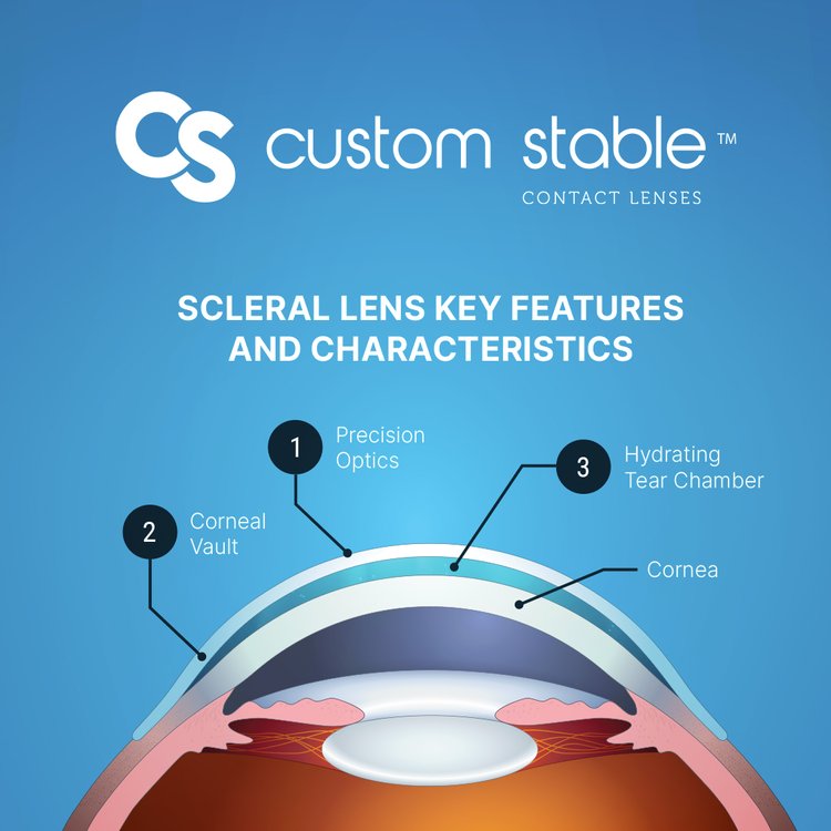 Scleral